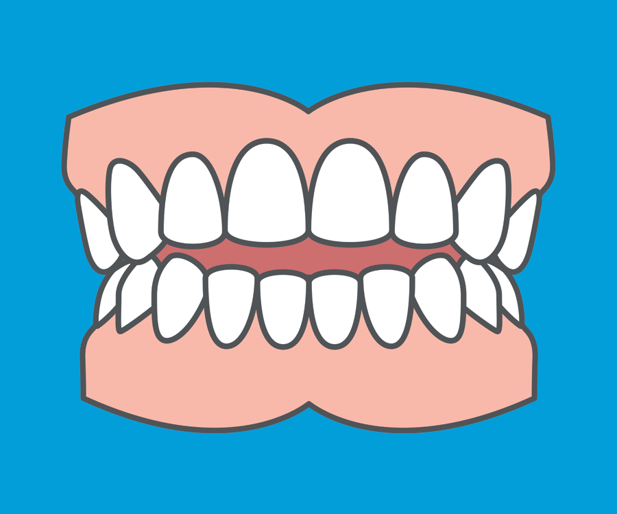 Common orthodontic problems - Open Bite. Most of the time, an open bite can be fixed using orthodontic treatment. Common orthodontic problems - Open Bite. Most of the time, an open bite can be fixed using orthodontic treatment.